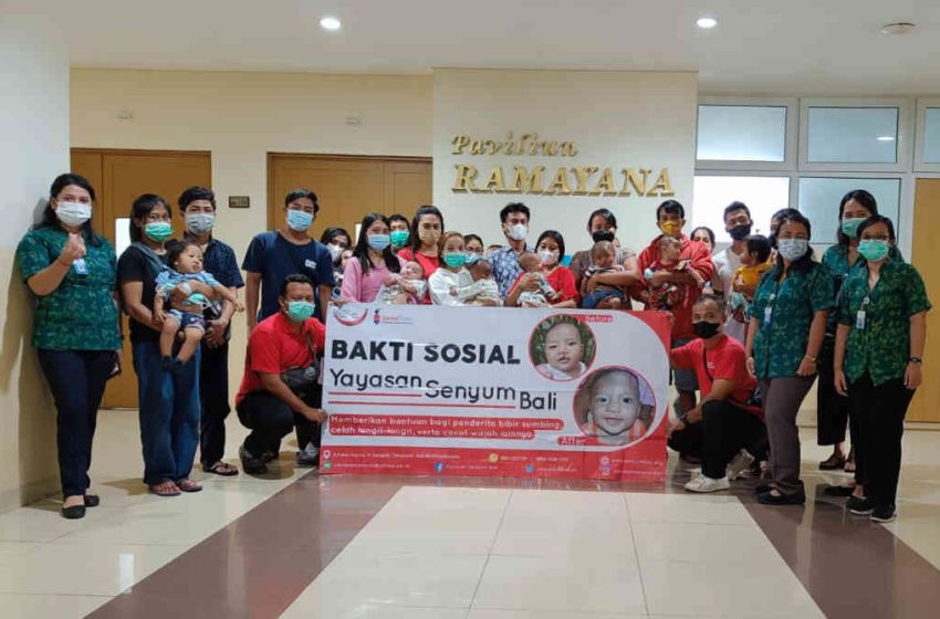  KIH Tabanan Didukung Yayasan Senyum Bali, Sukses Gelar Operasi Bibir Sumbing