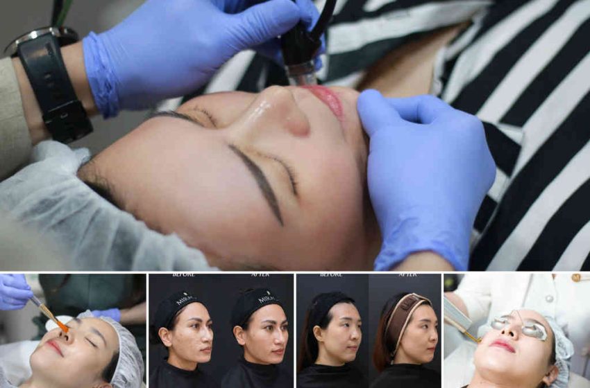  Pendekatan Menyeluruh Miracle Aesthetic Clinic, Tangani Hiperpigmentasi Kulit Pelanggan Indonesia